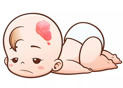 是哪些因素在影响血管瘤疾病的发展？